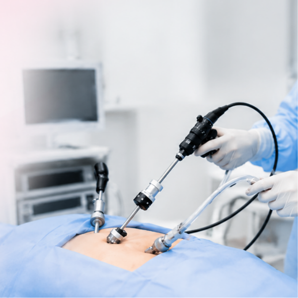 Laparoscopic Surgery